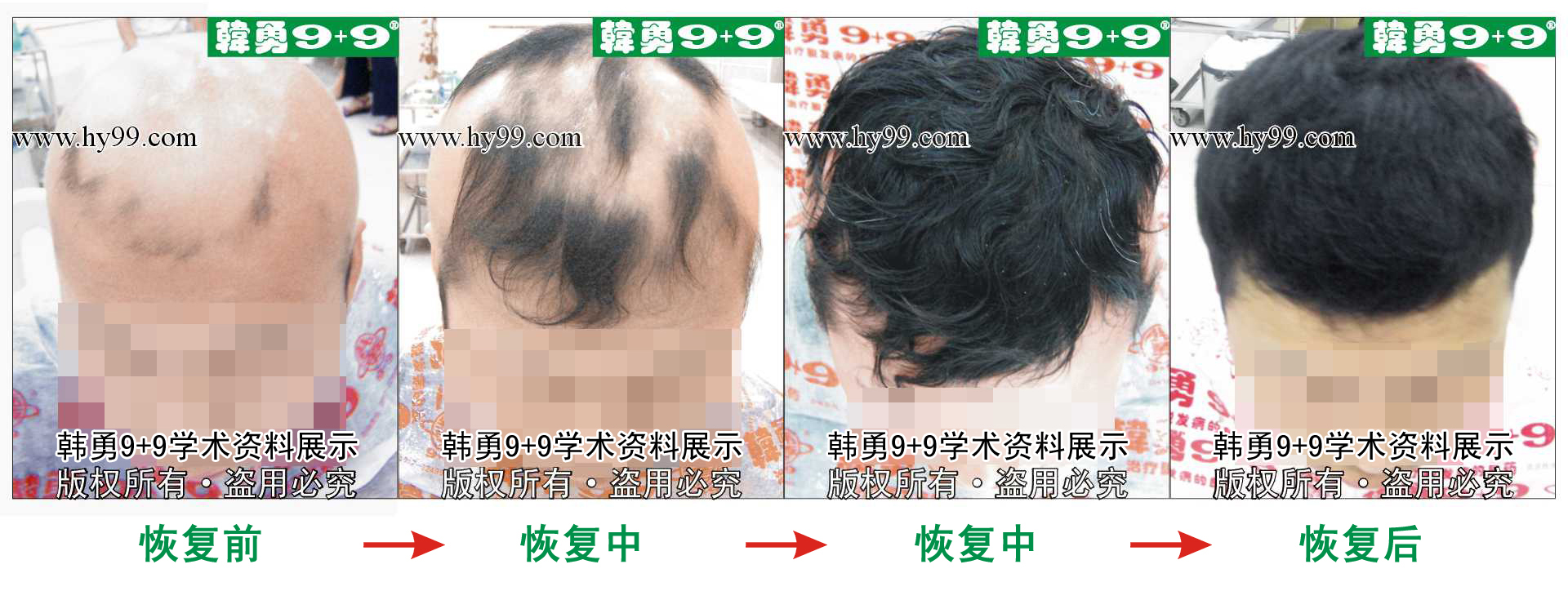 0005 HD_bantu bj105-51(1).jpg