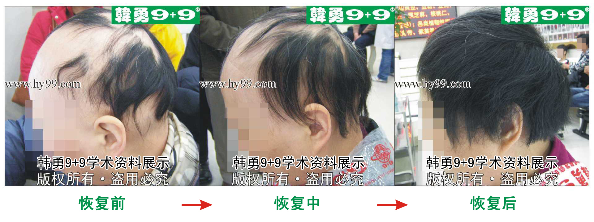 0011 HD_bantu bj115-19(2)b.jpg