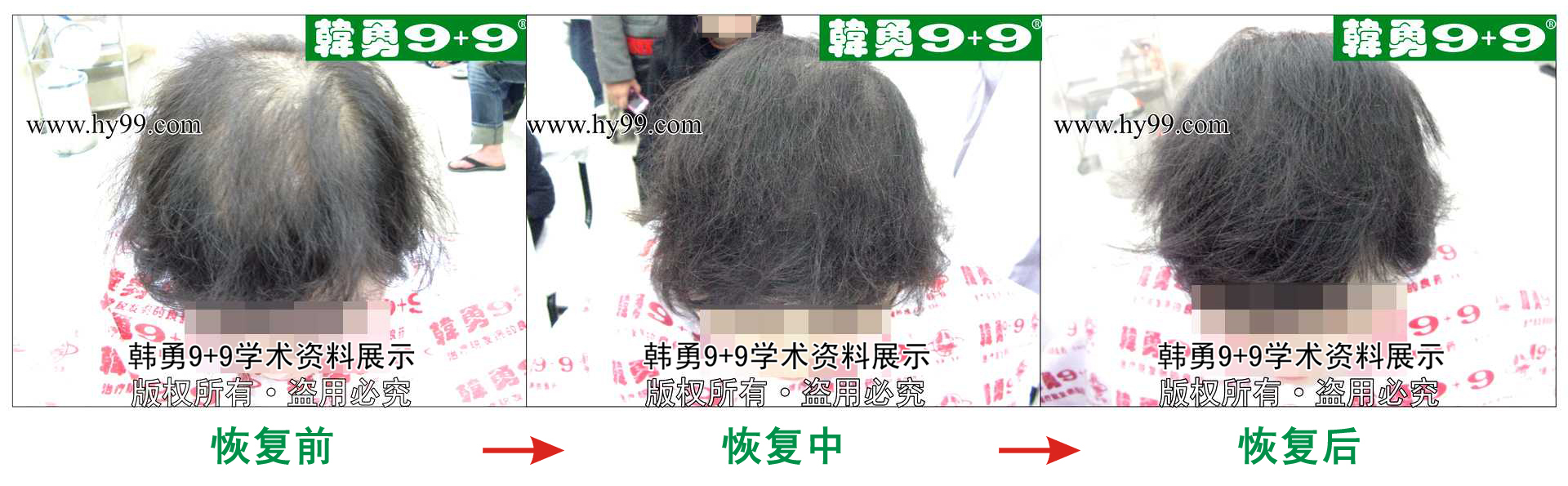 0018 HD_zhiyixing bj153-23a.jpg