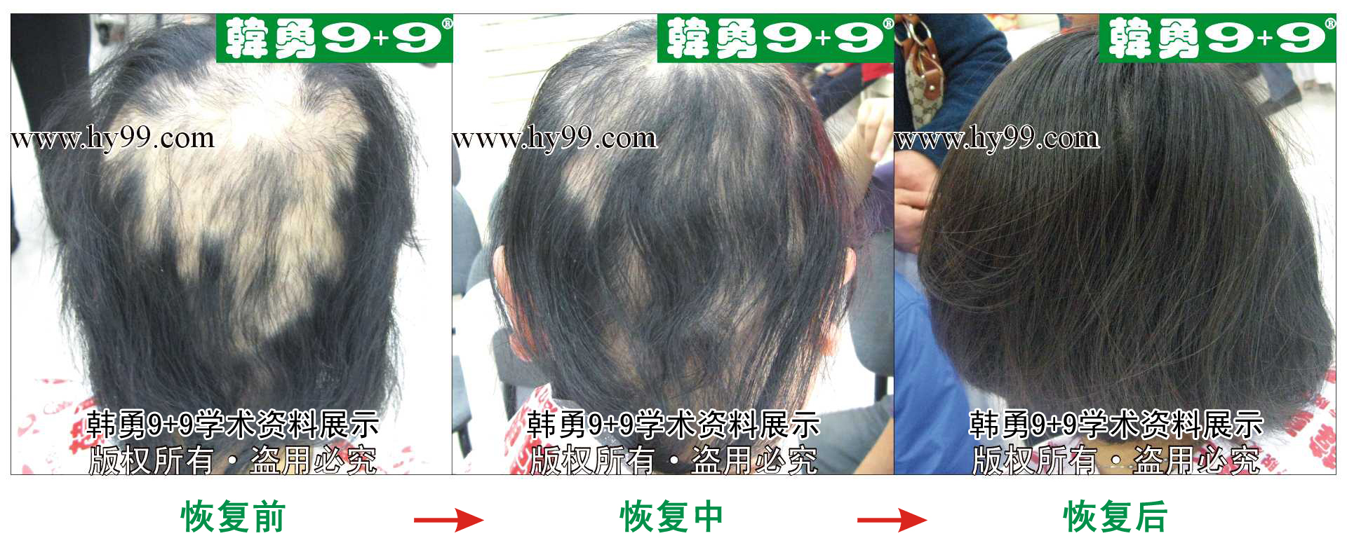 0023 HD_bantu bj131-50(1)b.jpg