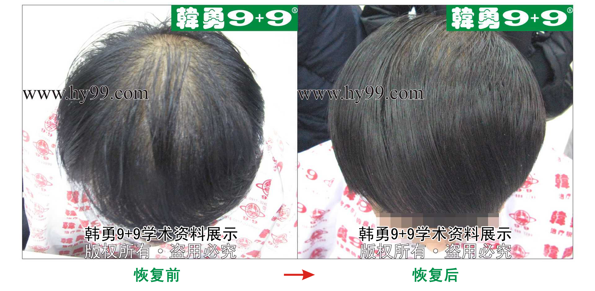 0024 HD_zhiyixing bj167-15a.jpg