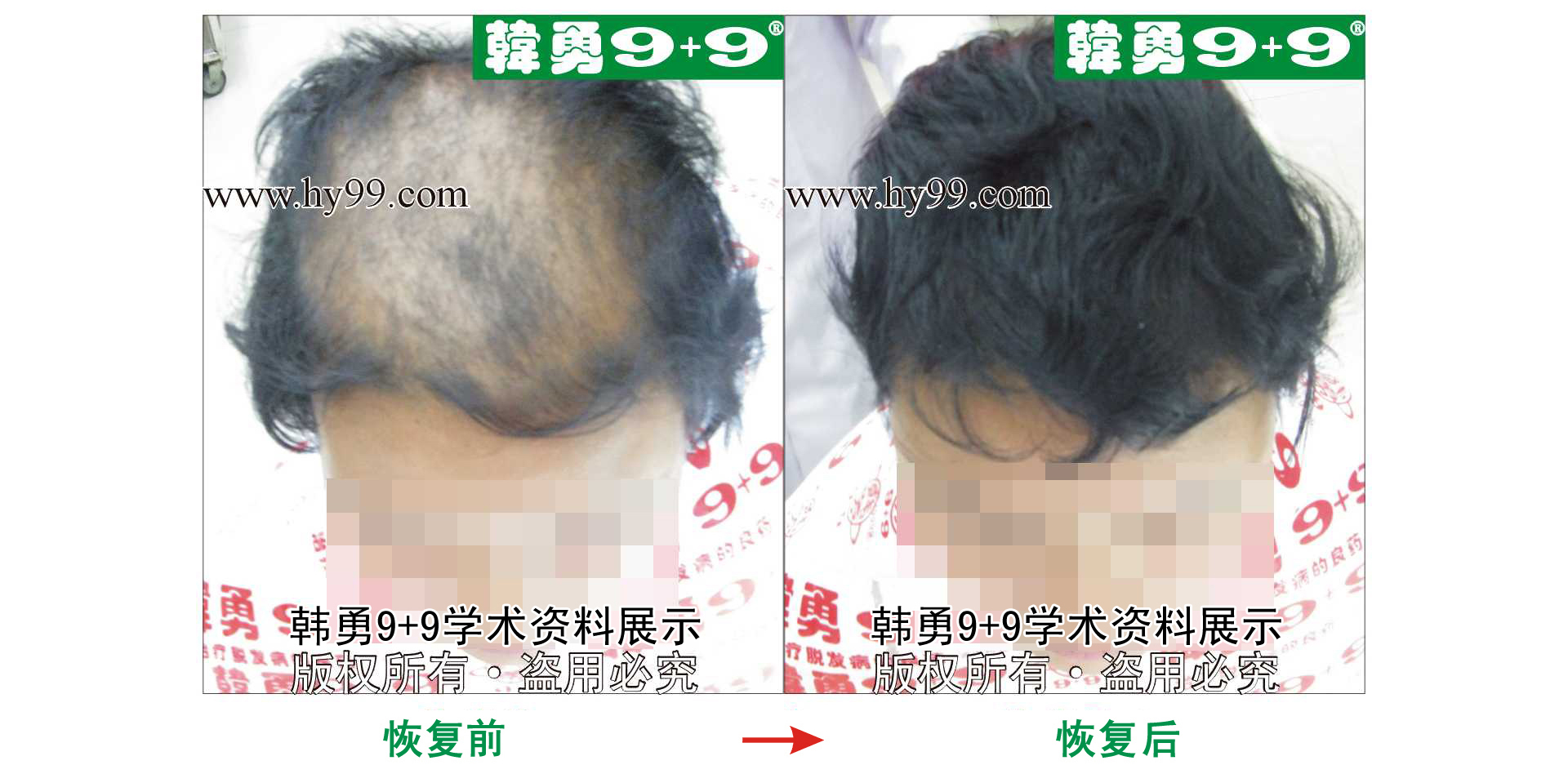 0025 HD_bantu bj134-21a.jpg