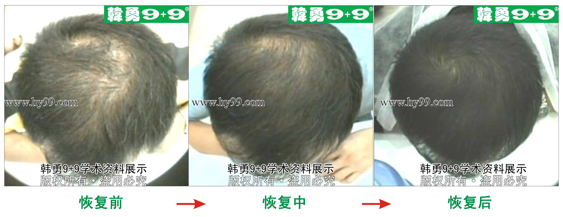 0046 HD_zhiyixing xa13-75.jpg