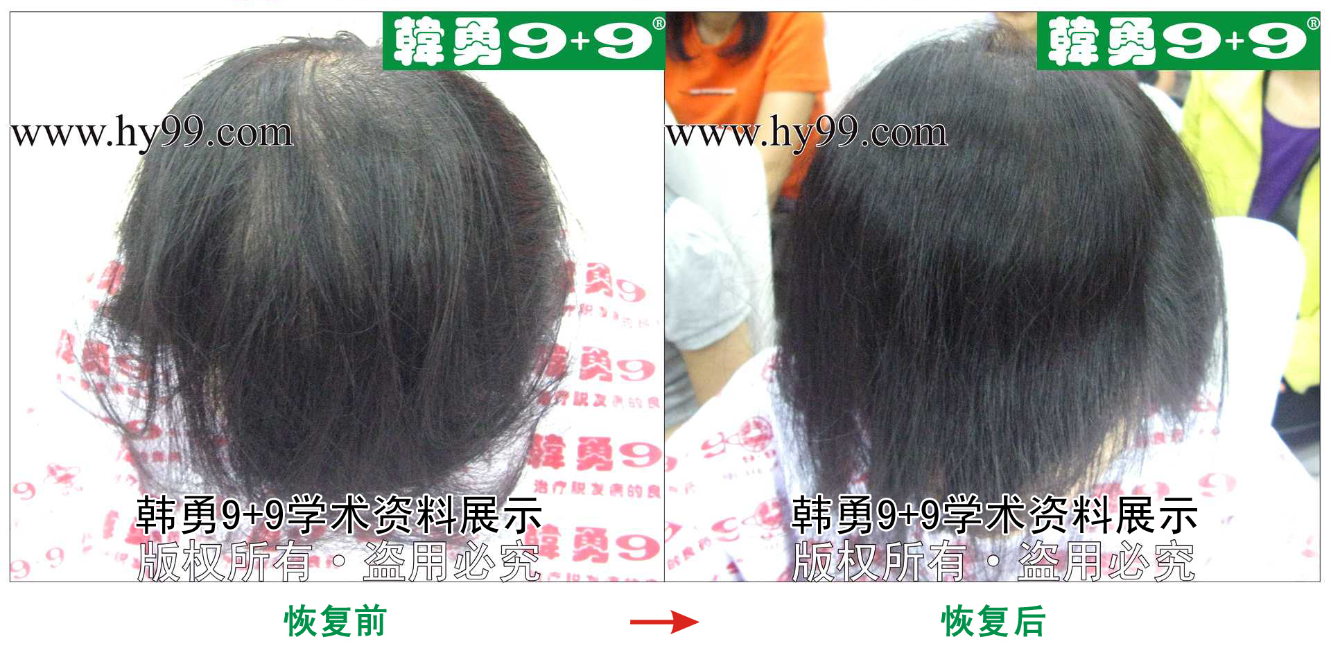 0030 HD_zhiyixing bj190-6a.jpg