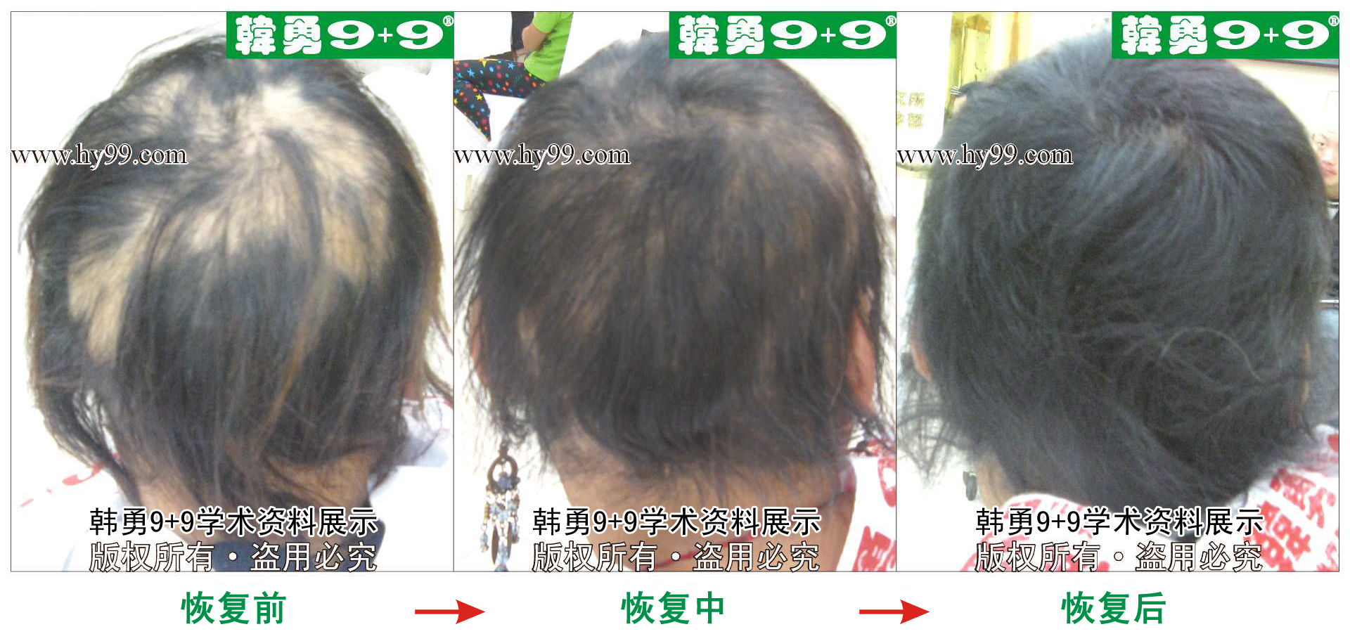 0033 HD_bantu bj144-18(1)b.jpg