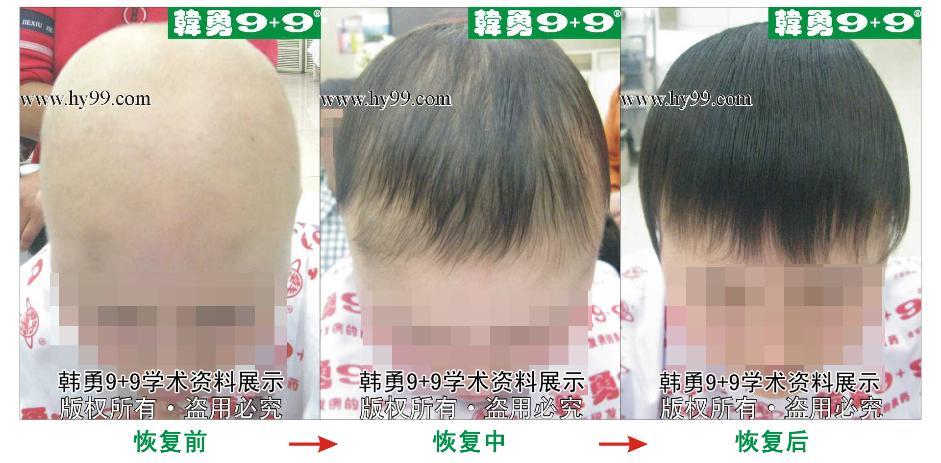 0037 HD_bantu bj144-49(1)a.jpg