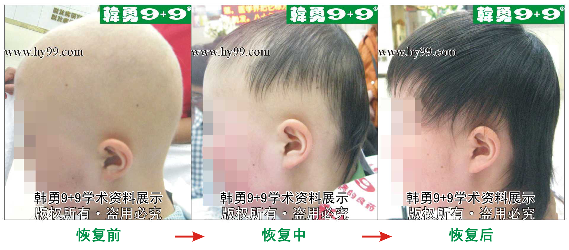 0037 HD_bantu bj144-49(2)a.jpg