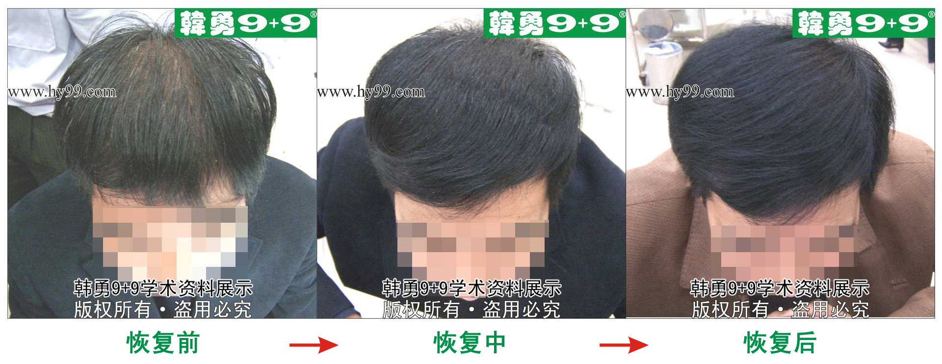 0038 HD_zhiyixing bj9996-65.jpg